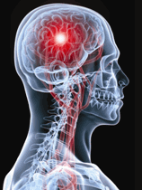 Traumatic brain injury